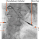Image: Medtronic